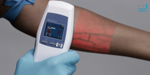 Công cụ AccuVein soi chiếu mạch máu phục vụ cho hoạt động lấy máu xét nghiệm